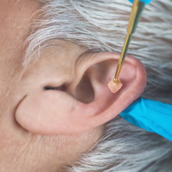 Auriculotherapy, or auricular treatment on human ear with flexible massage brass ear pen, close up. Acupuncture pressure on ear seed sticker.