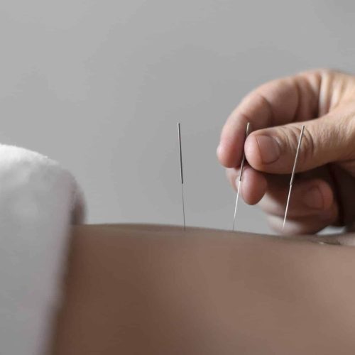 close-up-hand-holding-acupuncture-needle