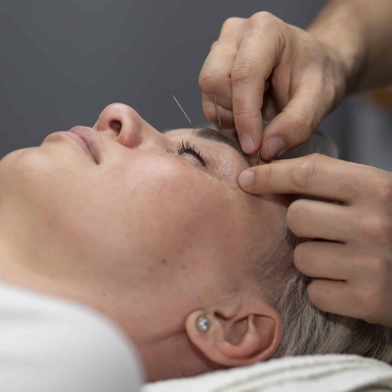 japanese-traditional-medicine-with-needles